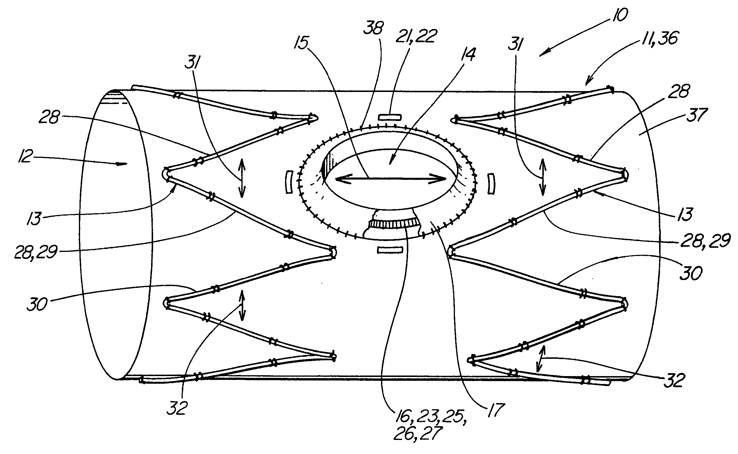 Stretchable prosthesis fenestration