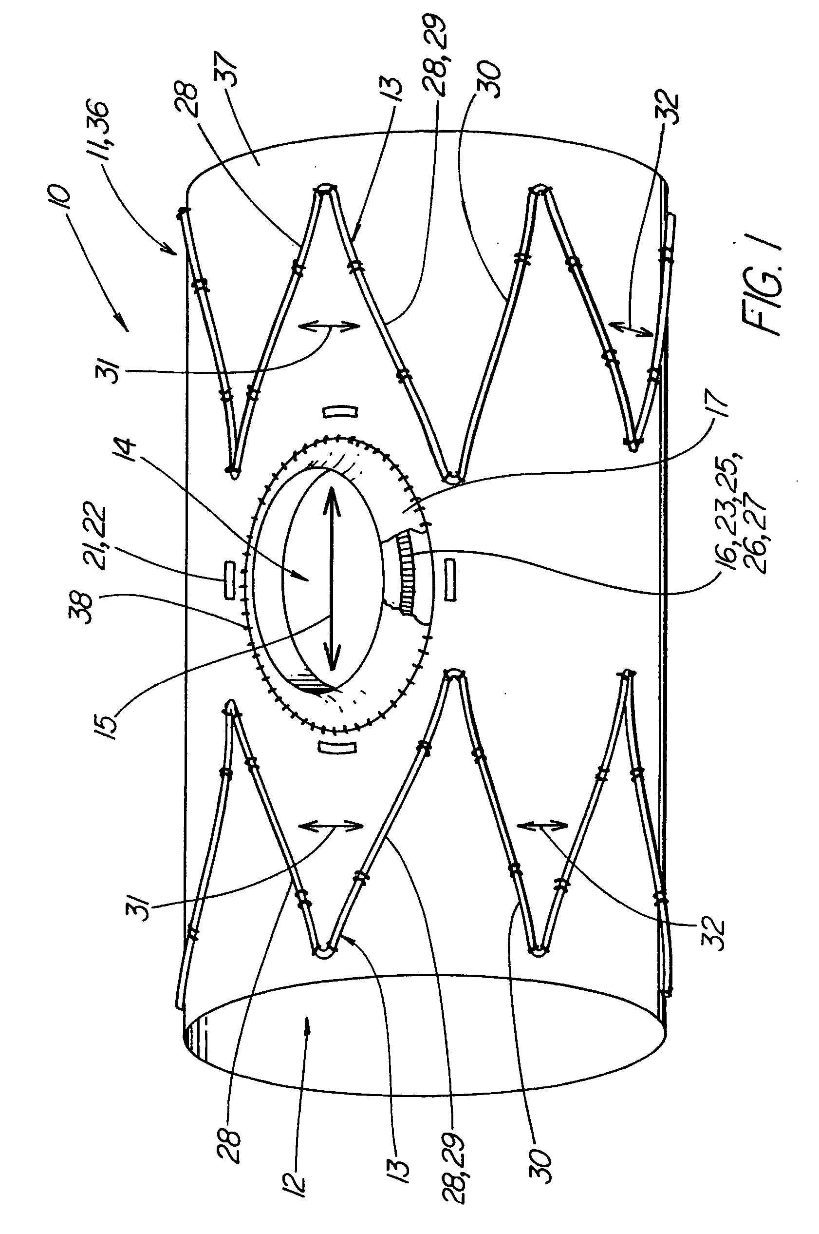 Stretchable prosthesis fenestration