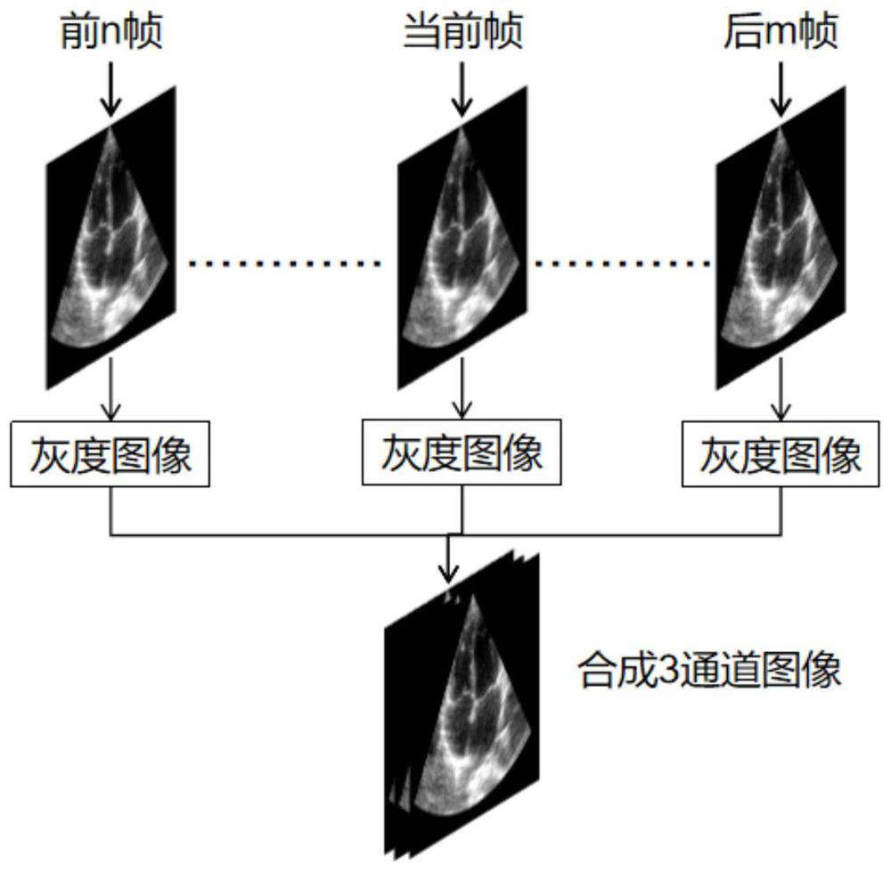 Cardiac ejection fraction calculation method and device