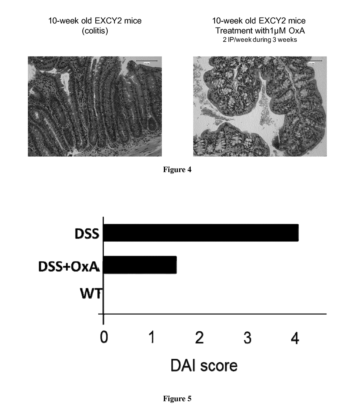 Pharmaceutical compositions comprising agonists of orexin-1 receptor ox1r for the treatment of inflammatory bowel diseases