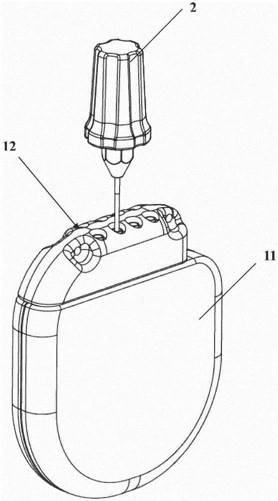 Implantable medical device and system with anti-screw screw-out structure