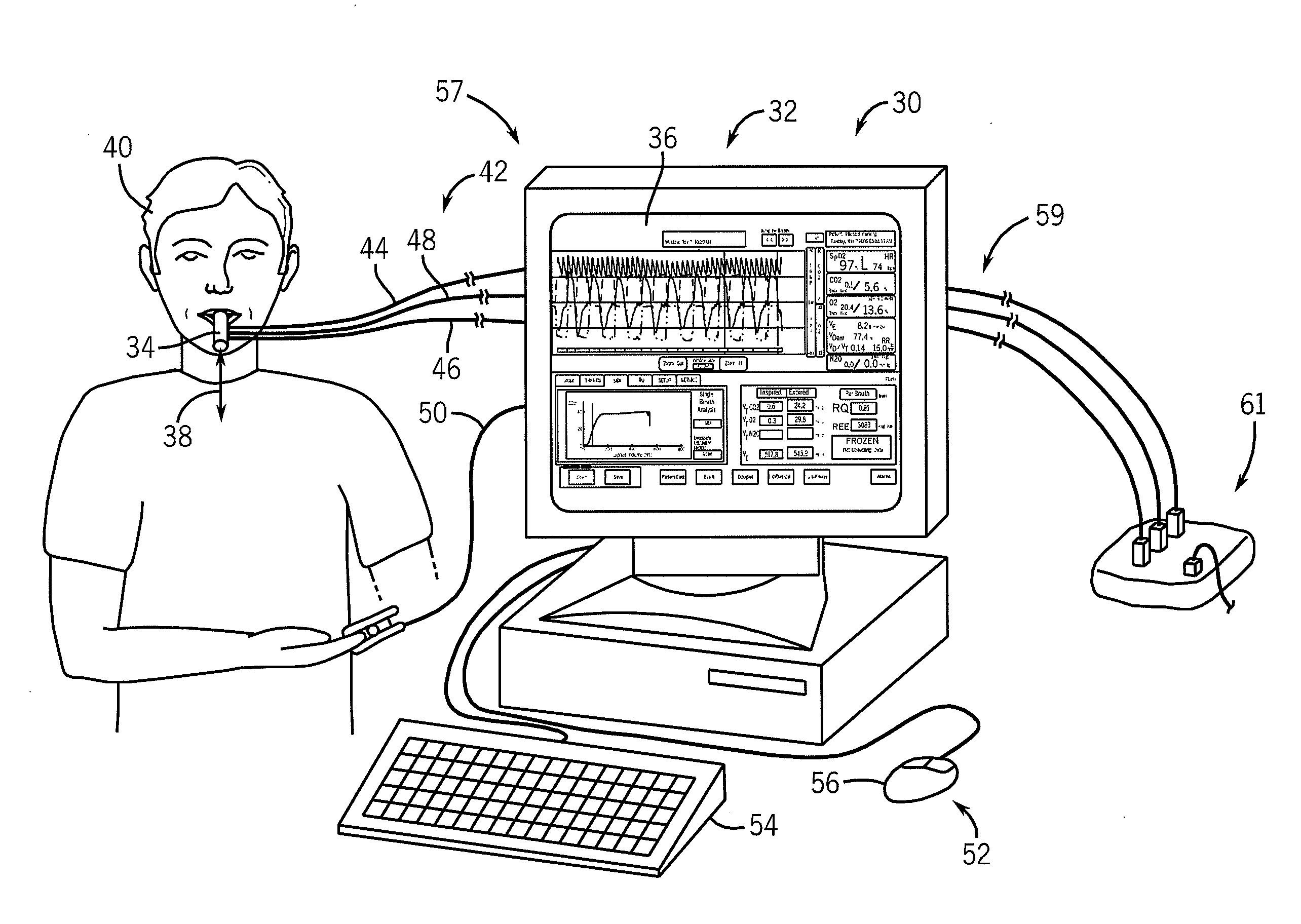 Premature infant side-stream respiratory gas monitoring sensor