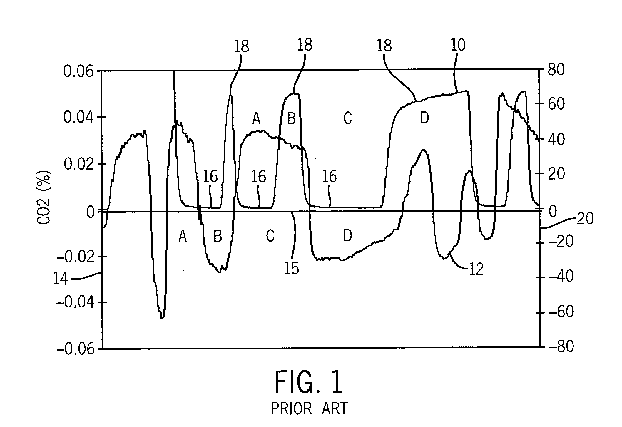 Premature infant side-stream respiratory gas monitoring sensor