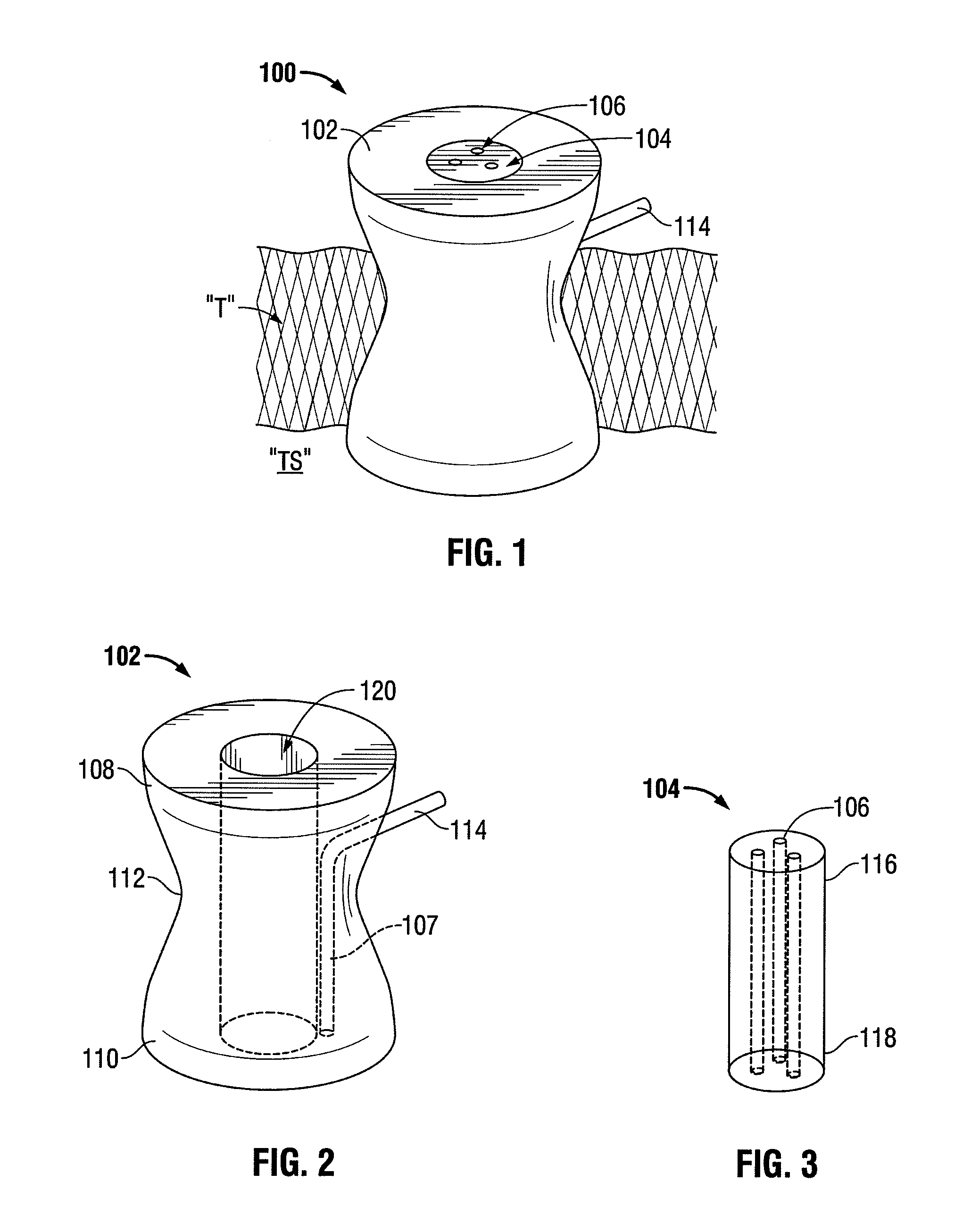 Single incision surgical portal apparatus including inner member