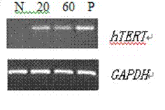 Preparation method of permanent cell line for multiplying orf virus