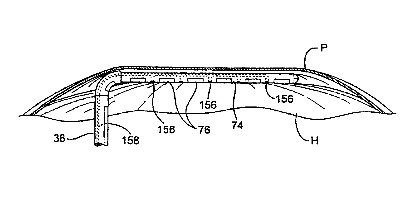 Apparatus and method for ablating tissue