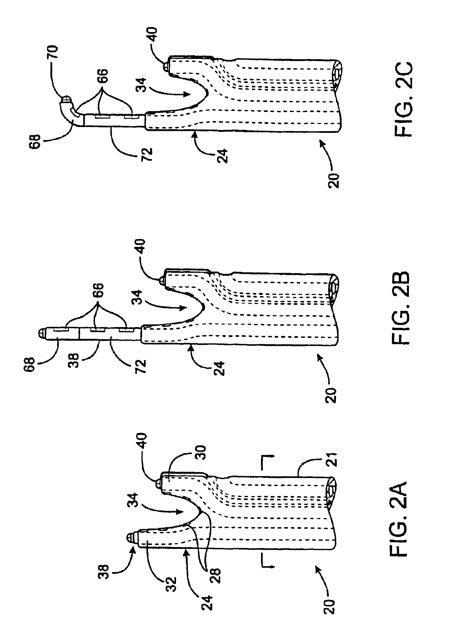 Apparatus and method for ablating tissue