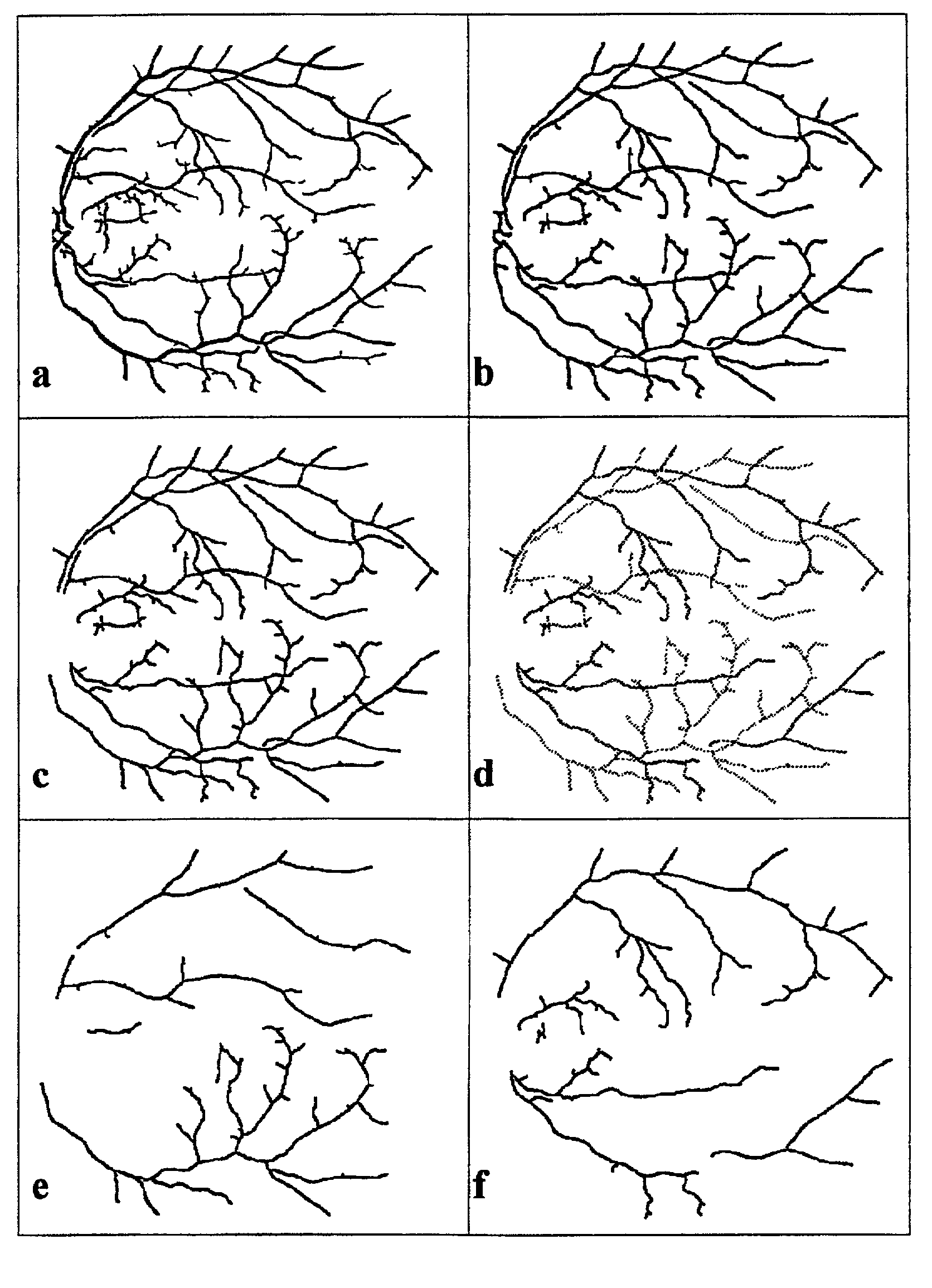 Analysis of fundus images