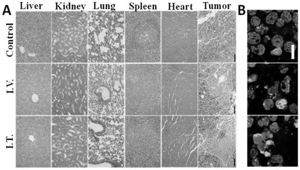 Method for cancer treatment based on combination of drugs