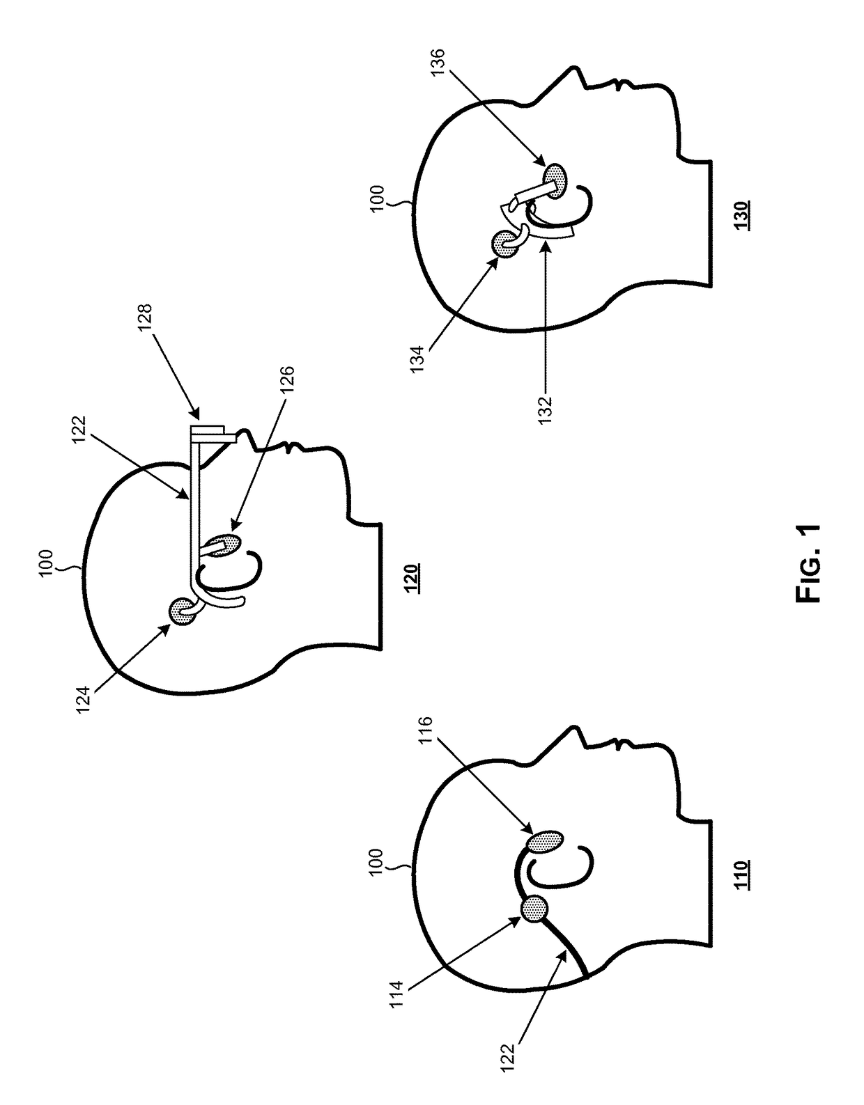 Equalization and power control of bone conduction elements