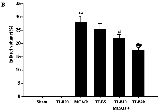 Application of trilobatin to cerebral ischemia-reperfusion injury preventing and treating drug