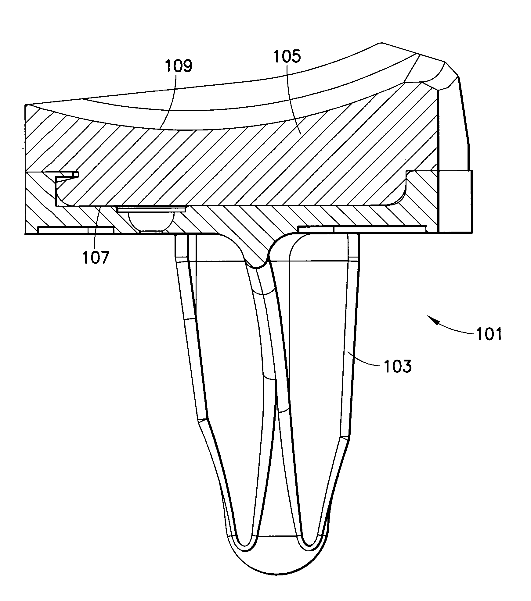 Knee prosthesis system with at least a first tibial portion element (a tibial insert or tibial trial) and a second tibial portion element (a tibial insert or tibial trial), wherein each of the first tibial portion element and the second tibial portion element has a different slope