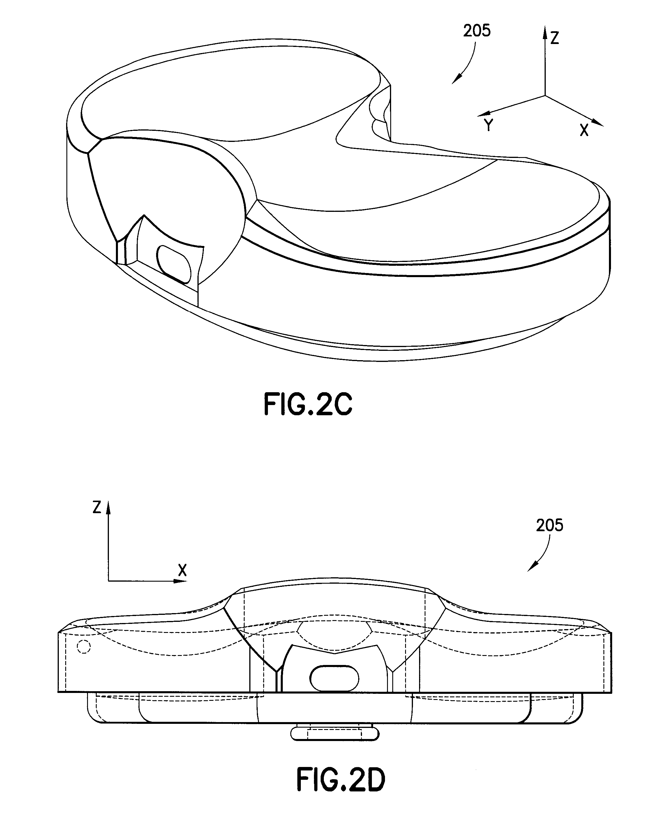 Knee prosthesis system with at least a first tibial portion element (a tibial insert or tibial trial) and a second tibial portion element (a tibial insert or tibial trial), wherein each of the first tibial portion element and the second tibial portion element has a different slope