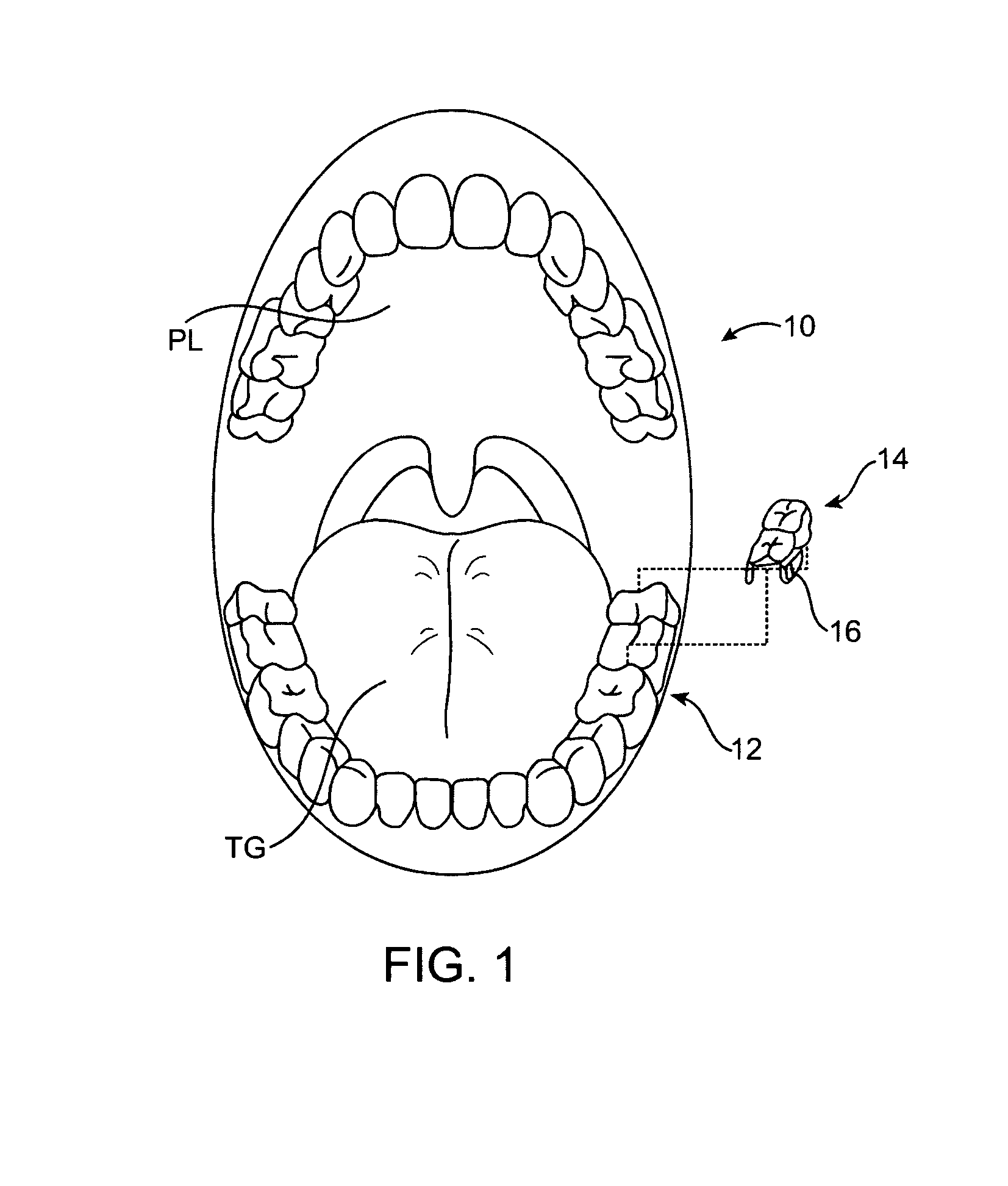 Tinnitus masking systems