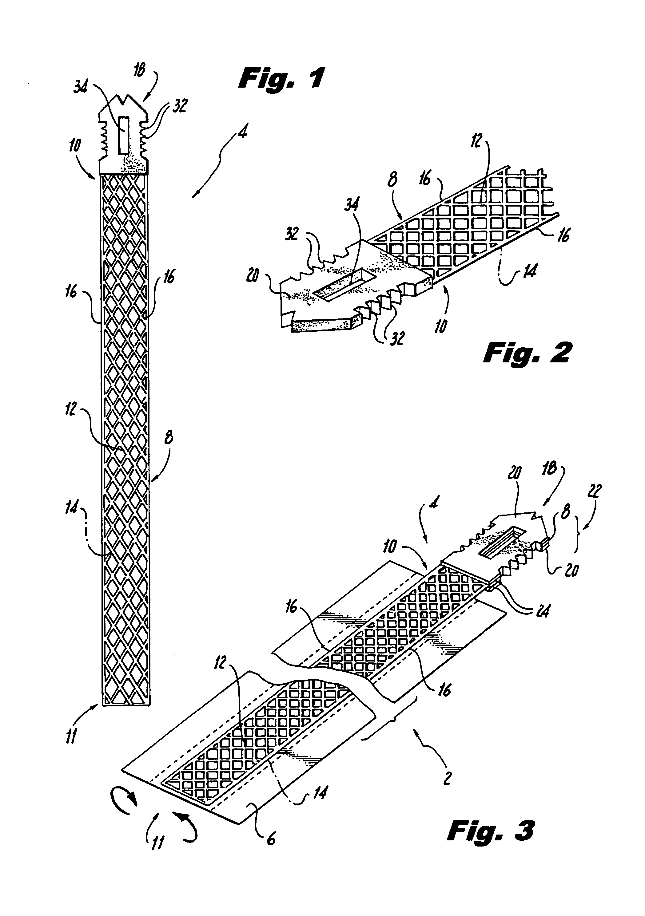 Self-anchoring tissue lifting device, method of manufacturing same and method of facial reconstructive surgery using same