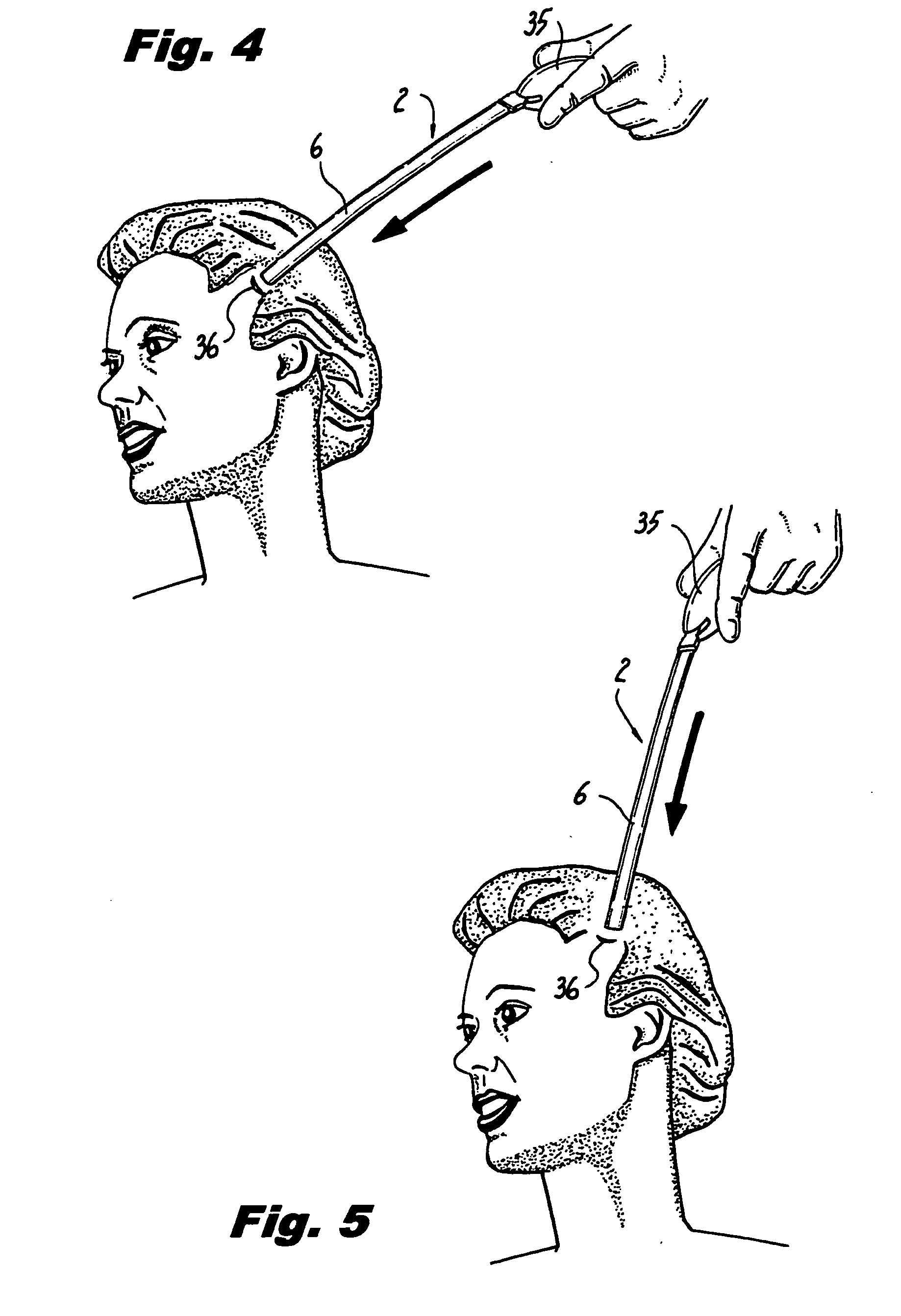 Self-anchoring tissue lifting device, method of manufacturing same and method of facial reconstructive surgery using same