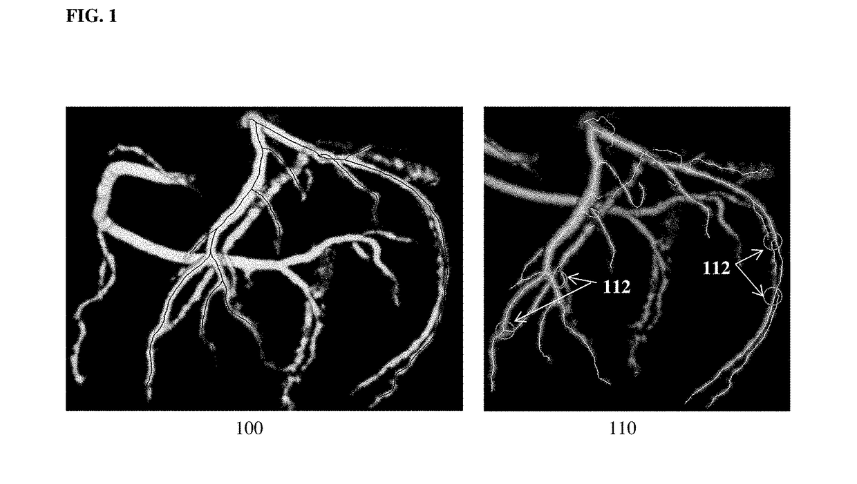 Method and System for Extracting Centerline Representation of Vascular Structures in Medical Images Via Optimal Paths in Computational Flow Fields