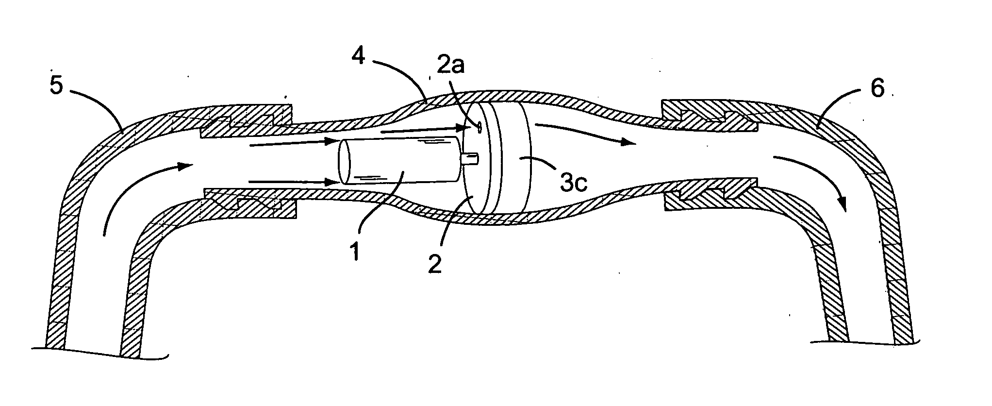 Adjustable resistance valve for a cerebrospinal fluid shunt system