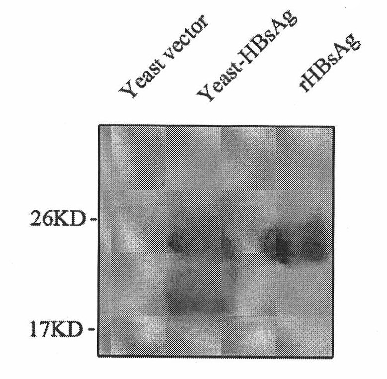 Vaccine for controlling persistent infection of hepatitis B virus