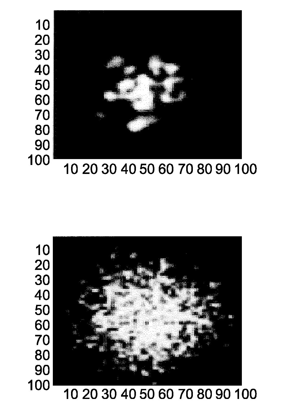 Optical laser speckle sensor for measuring a blood perfusion parameter