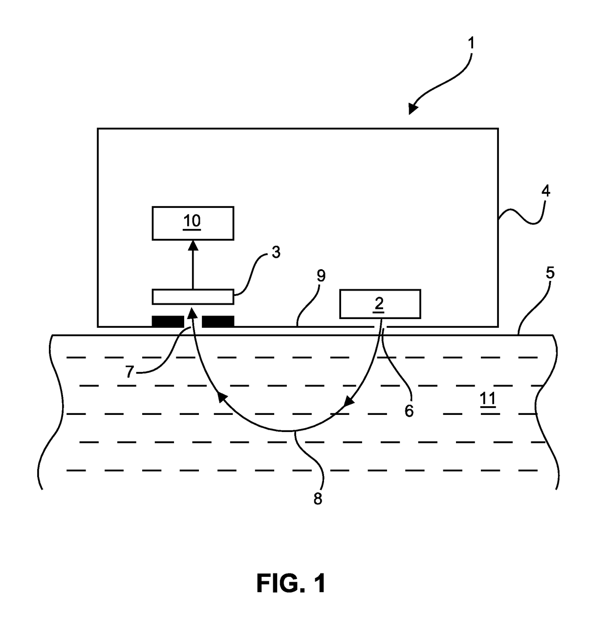 Optical laser speckle sensor for measuring a blood perfusion parameter