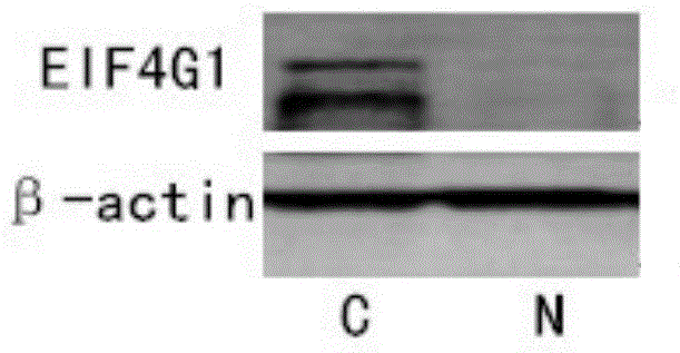 Applications of EIF4G1 in diagnosis and treatment of squamous cell carcinomas