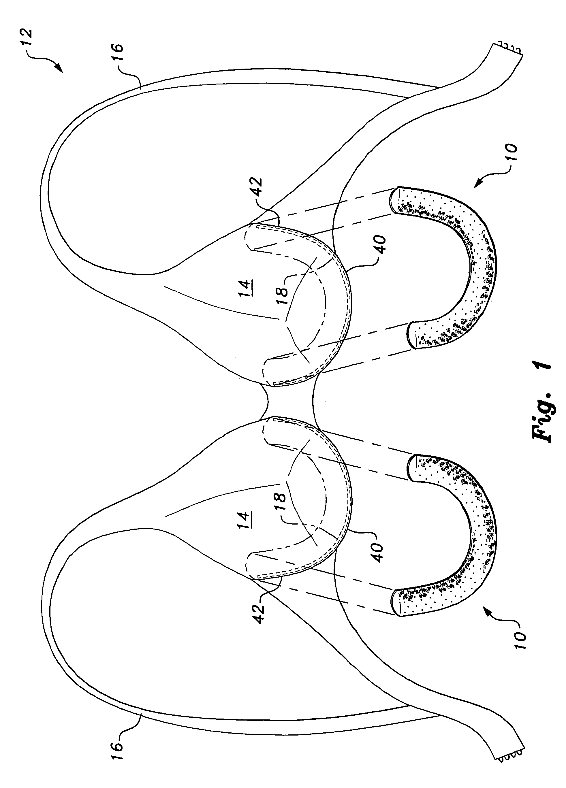 Absorbent pad for underwire brassiere