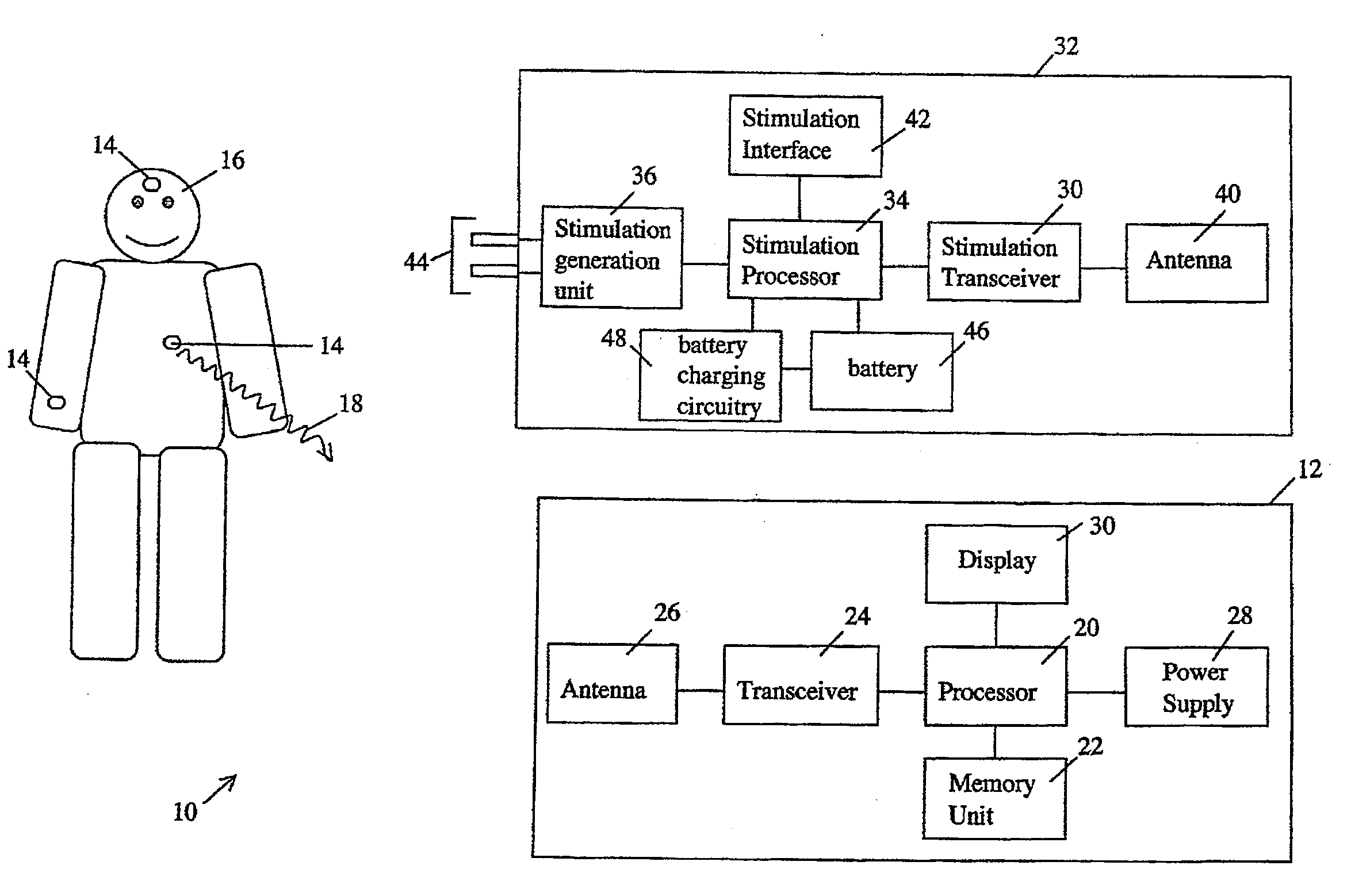 Wireless physiological monitoring