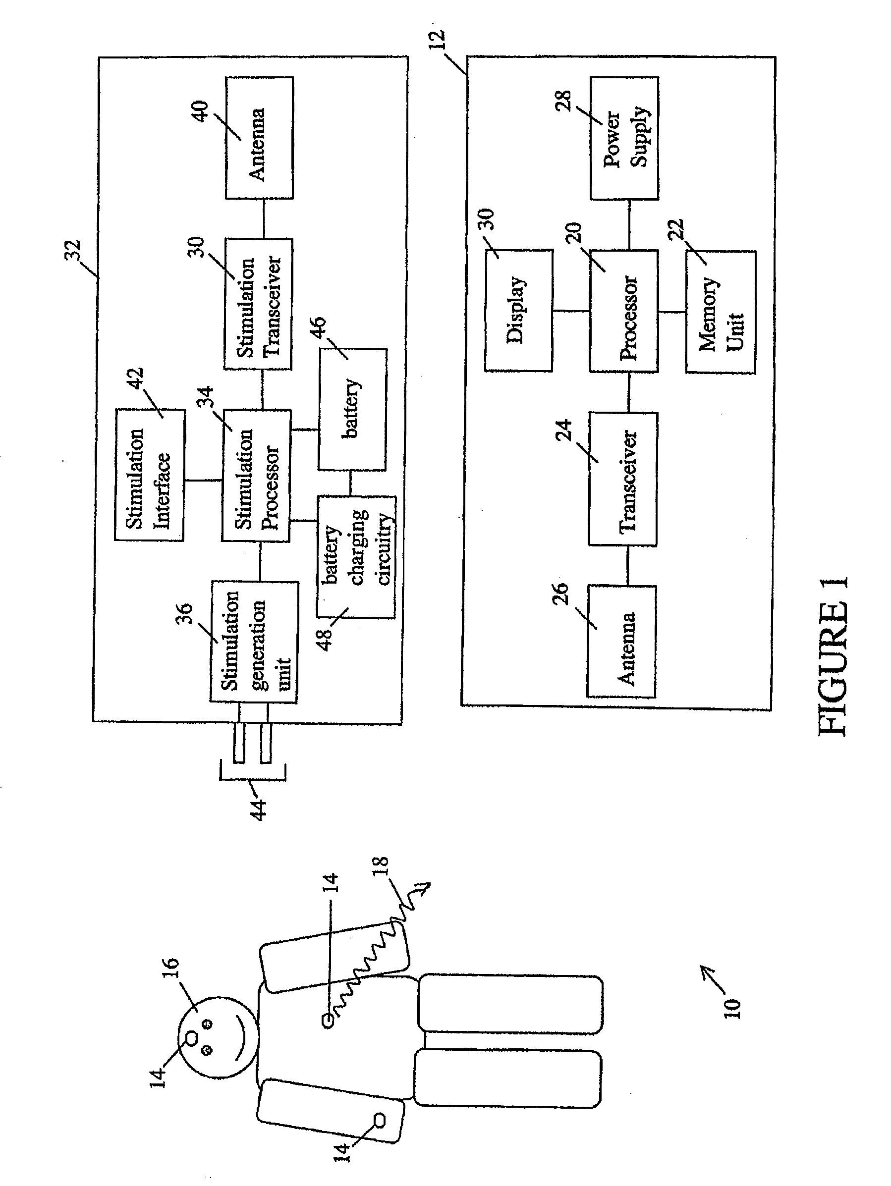 Wireless physiological monitoring