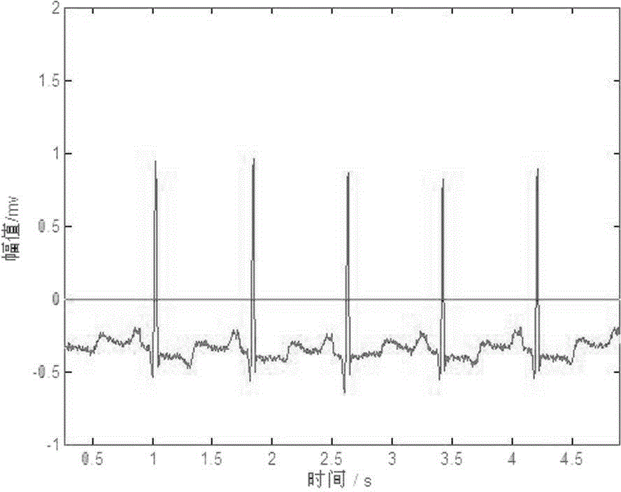 A method for detecting r-characteristic wave of electrocardiographic signal