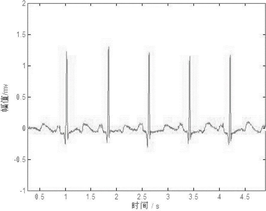 A method for detecting r-characteristic wave of electrocardiographic signal