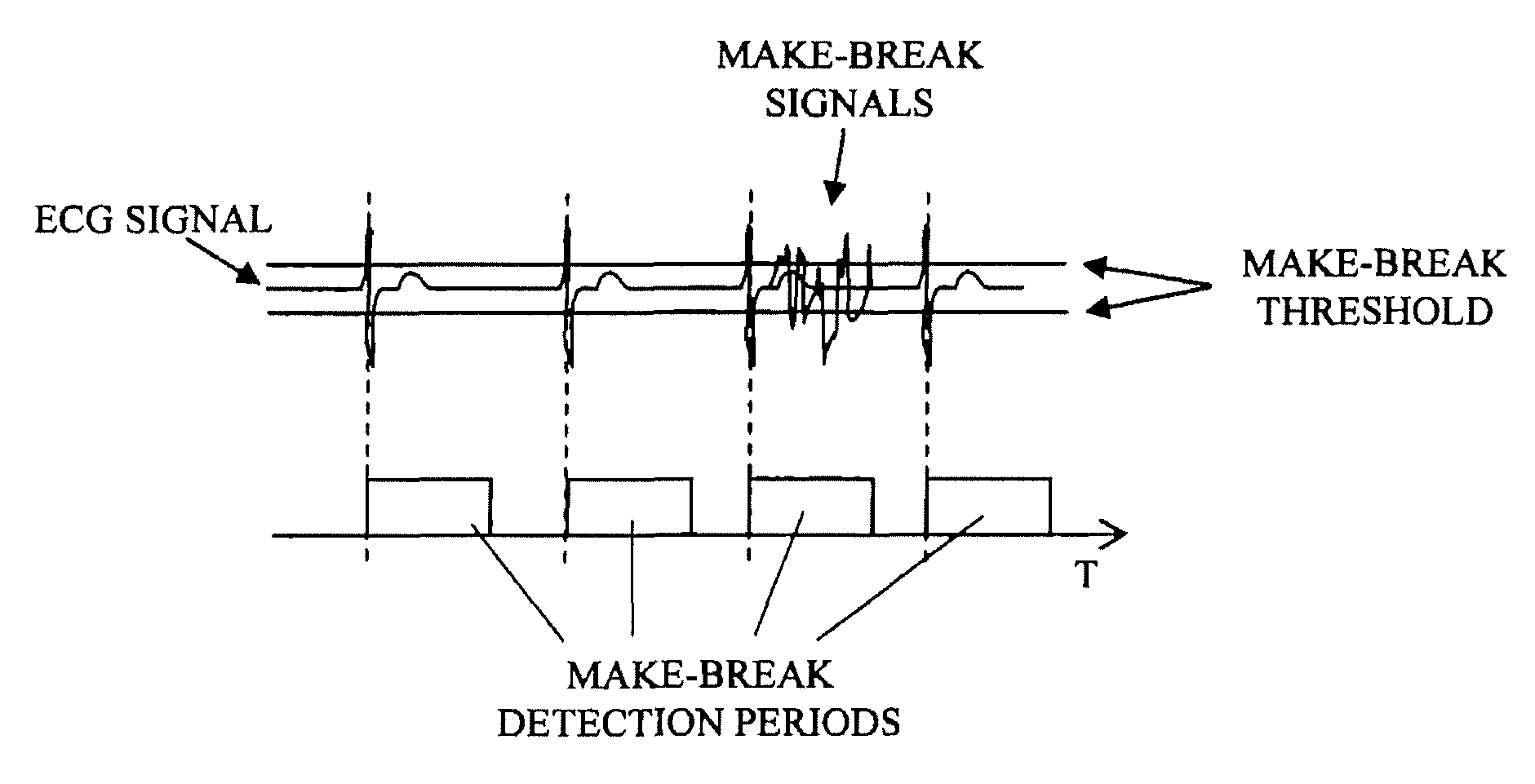 Implantable medical device with lead failure detection