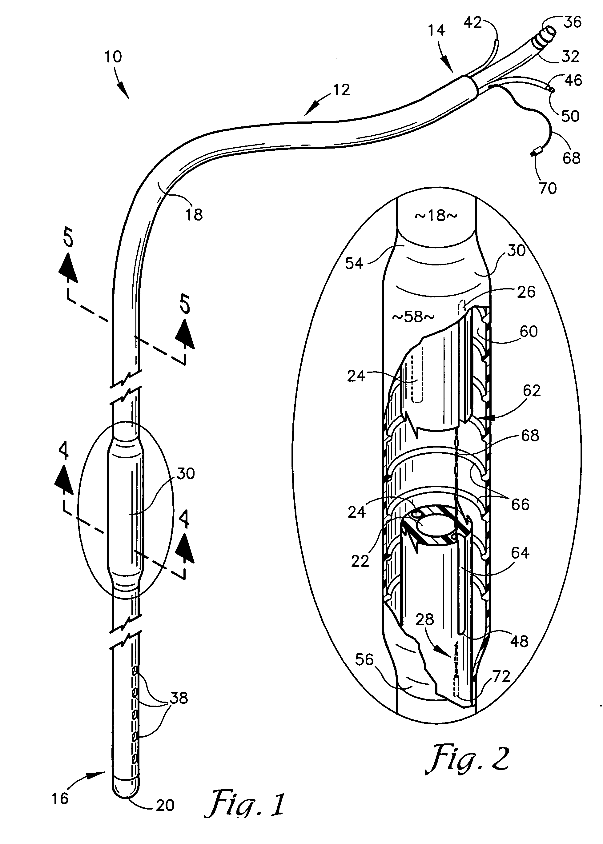 Internally vented multi-function esophageal gastric tube