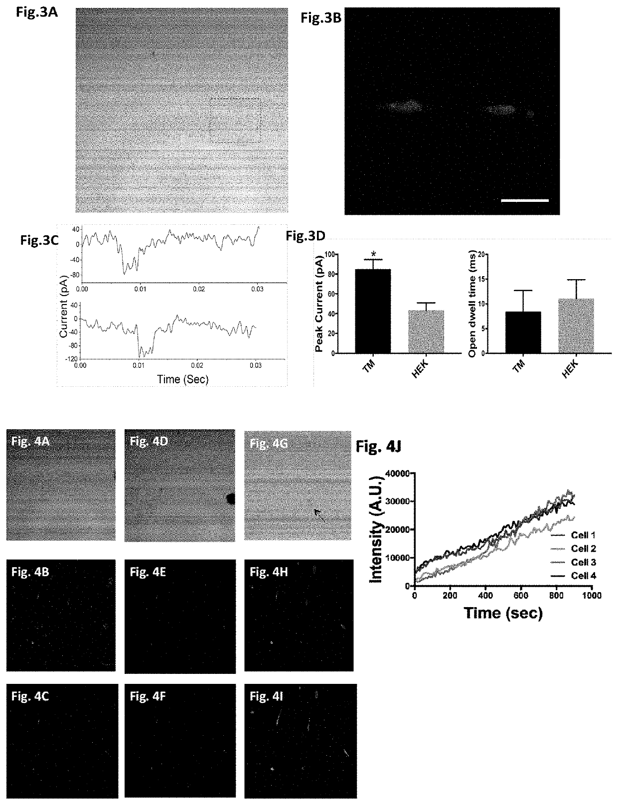 Method, Compositions and Applications of Mechanosensitive Channels in Visual Disorders and Other Applications Thereof