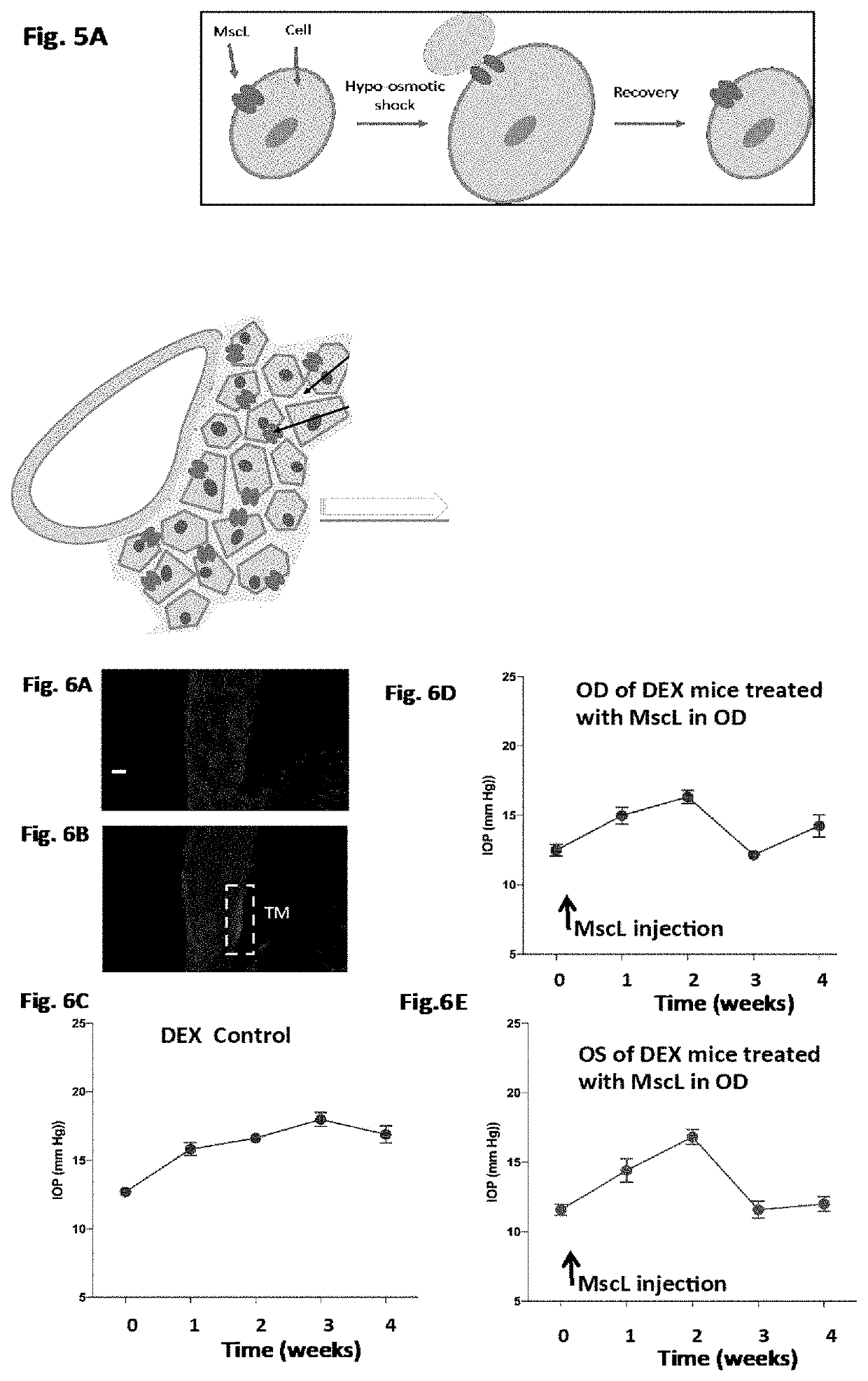 Method, Compositions and Applications of Mechanosensitive Channels in Visual Disorders and Other Applications Thereof