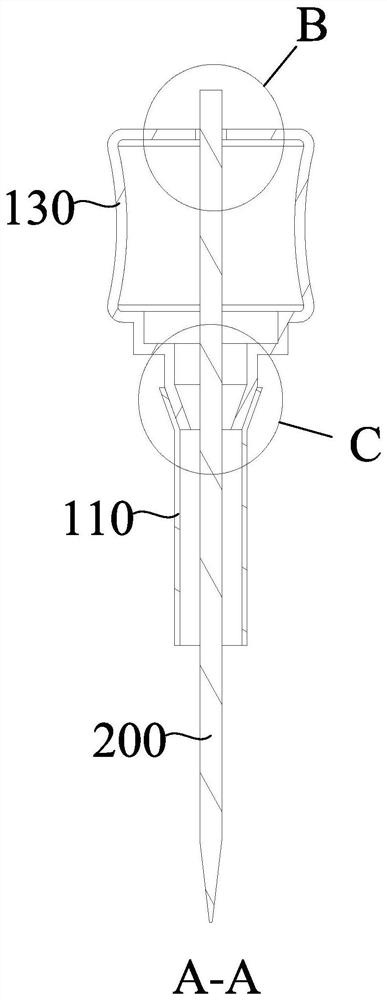 Bone Transport Minimally Invasive Nail-Plate System