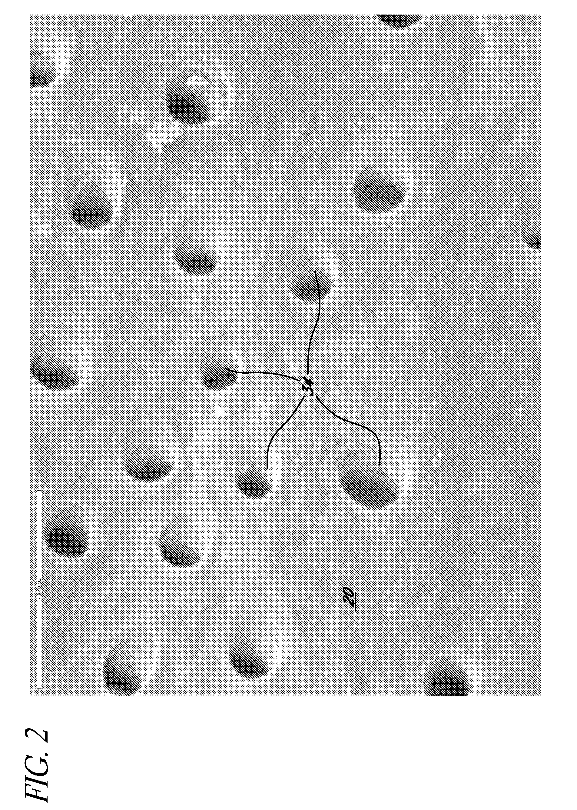 Apparatus and methods for treating root canals of teeth