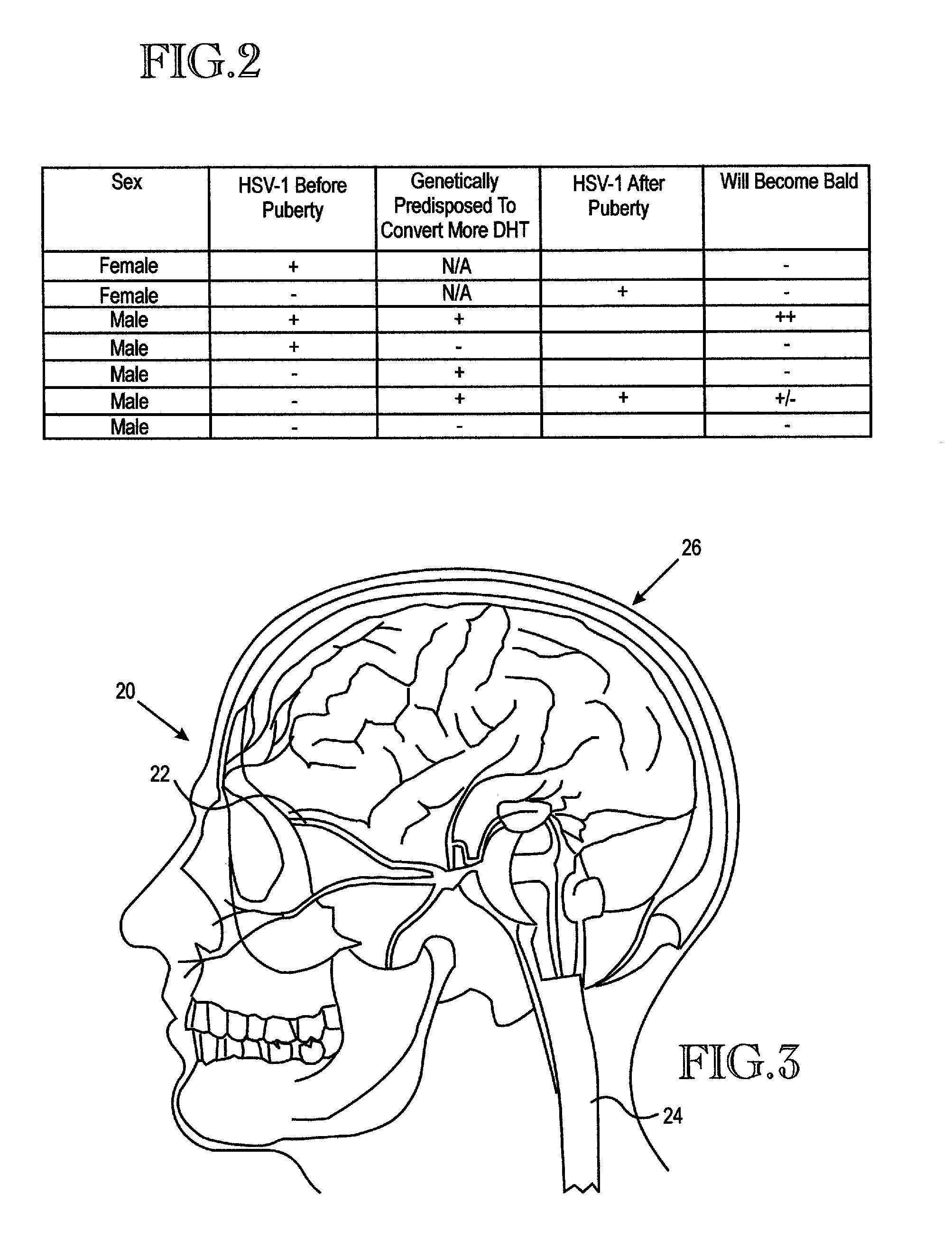 Method and kit for treatment/prevention of hair loss