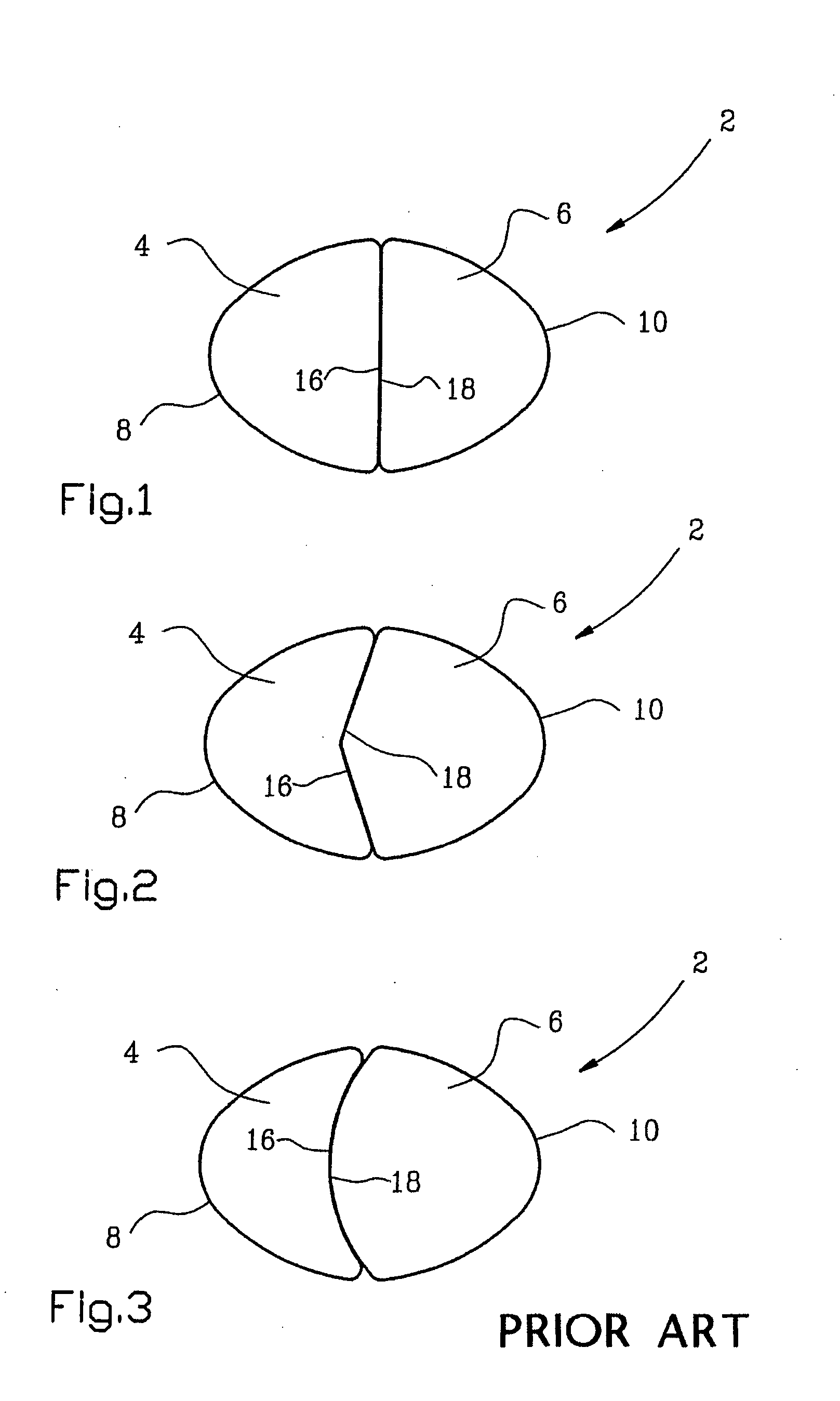 Mounting device for orthodontic retainer elements and a method of maintaining said elements in place for mounting on corresponding teeth