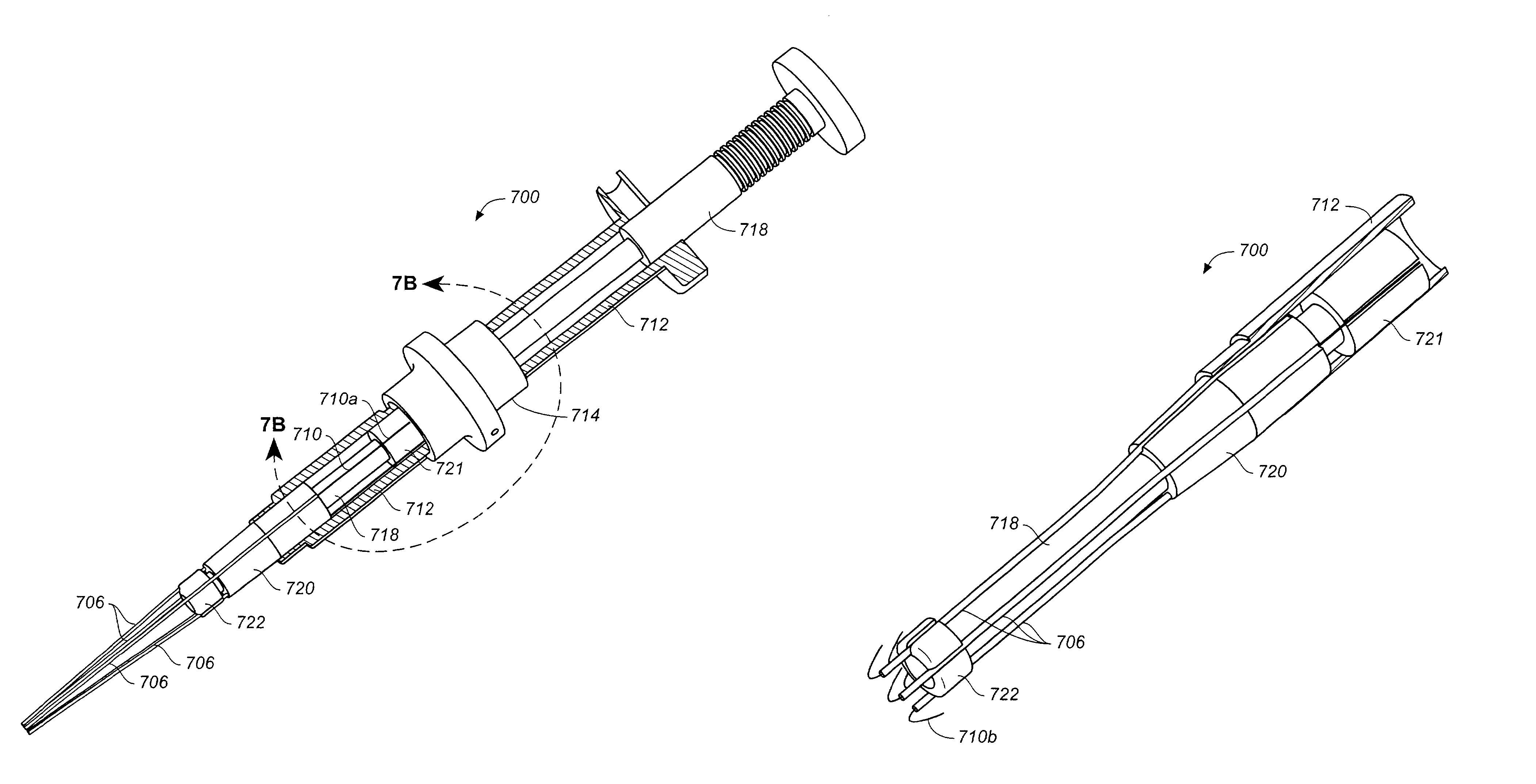 Anastomosis apparatus and methods