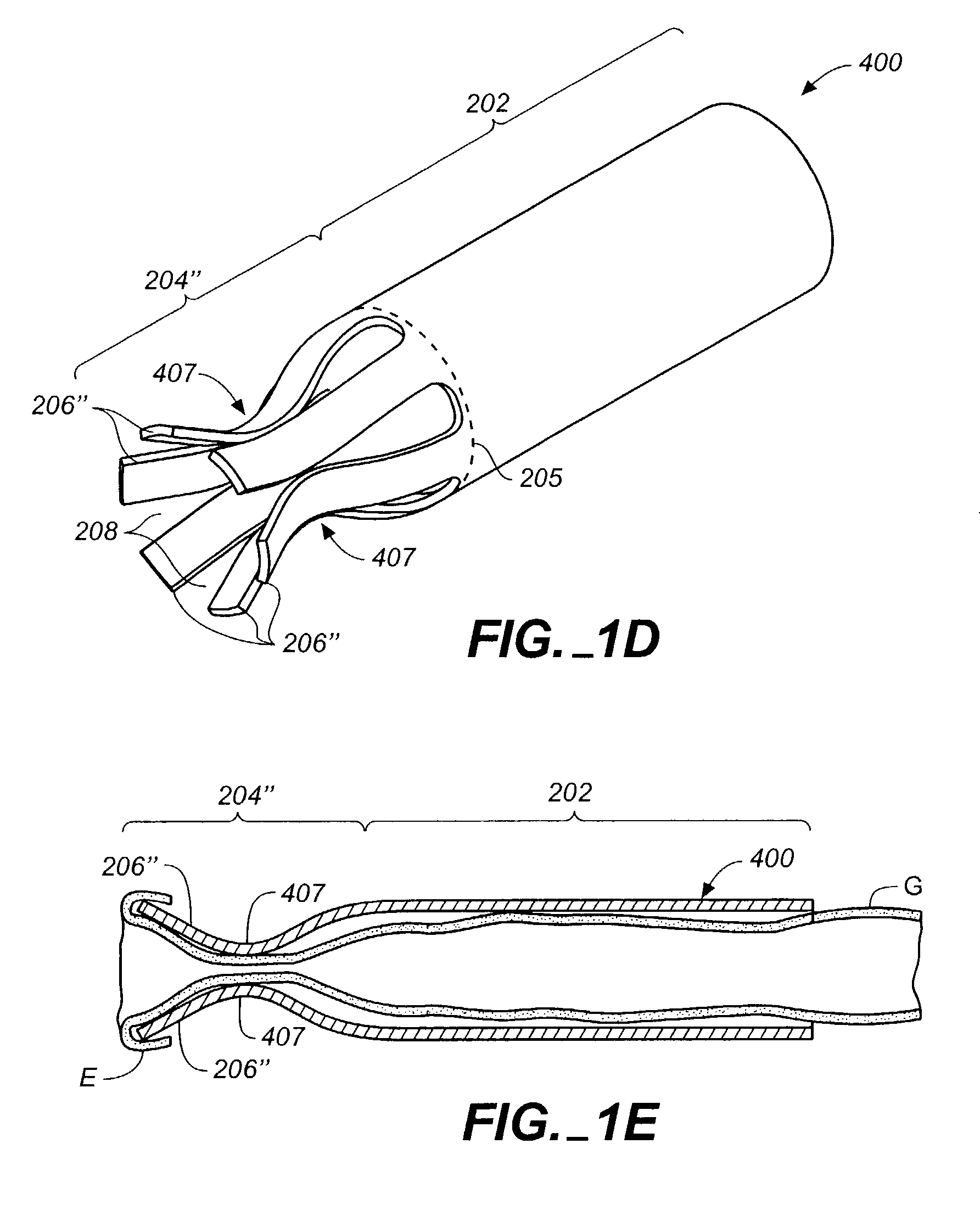 Anastomosis apparatus and methods