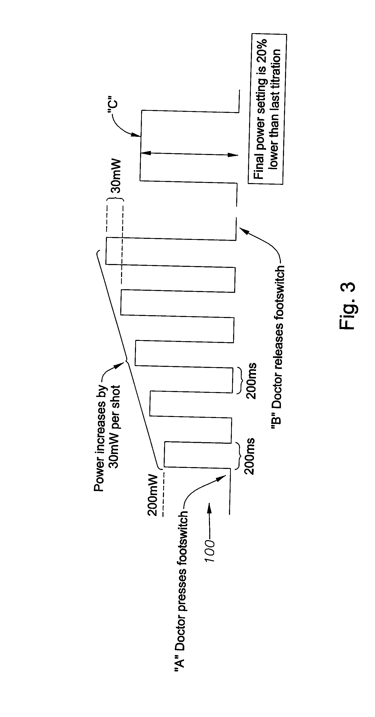 Apparatus and method for auto-titrating a laser