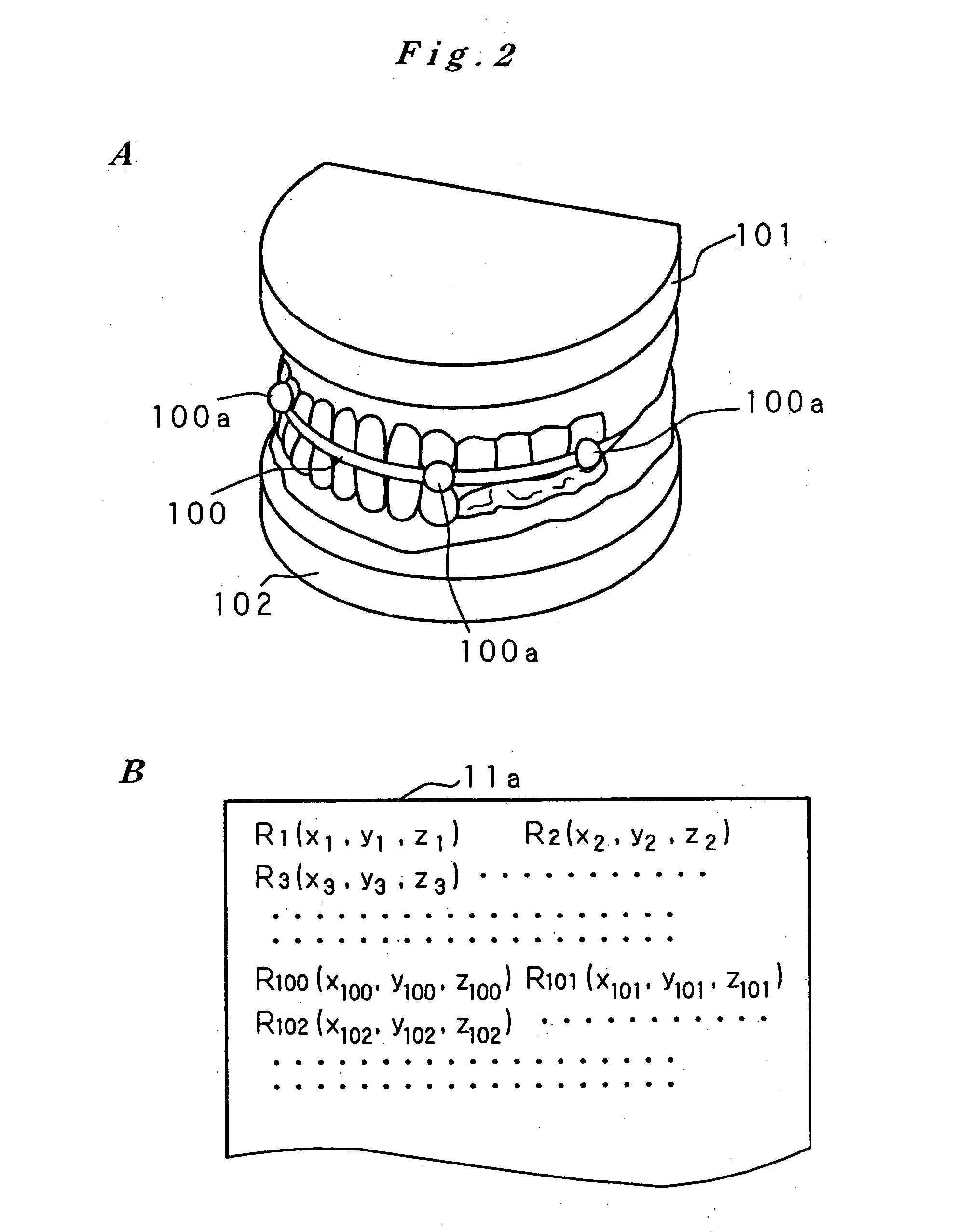 Artificial tooth root implantation position determining instrument, artificial tooth root implantation position determining method, guide member manufacturing device, sensor, drill, artificial tooth manufacturing device, computer program, and recorded medium