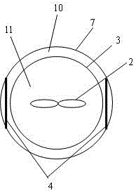 A kind of preparation method of pseudo-boehmite