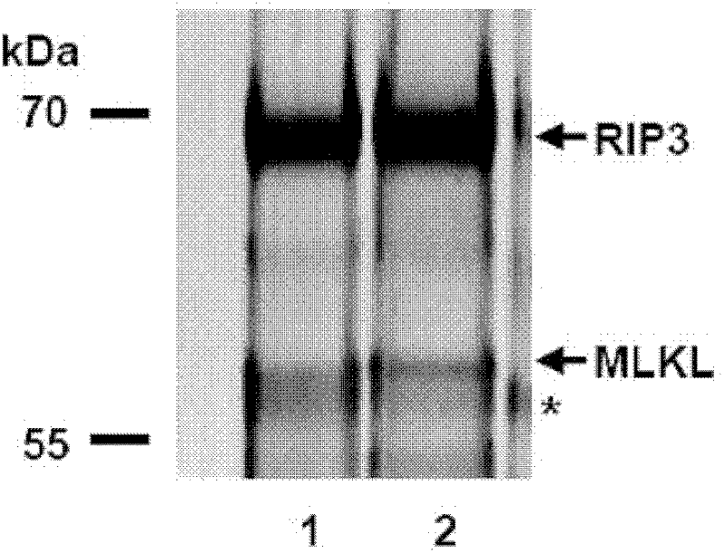 MLKL protein and application of MLKL protein as target point of cell necrosis inhibitor