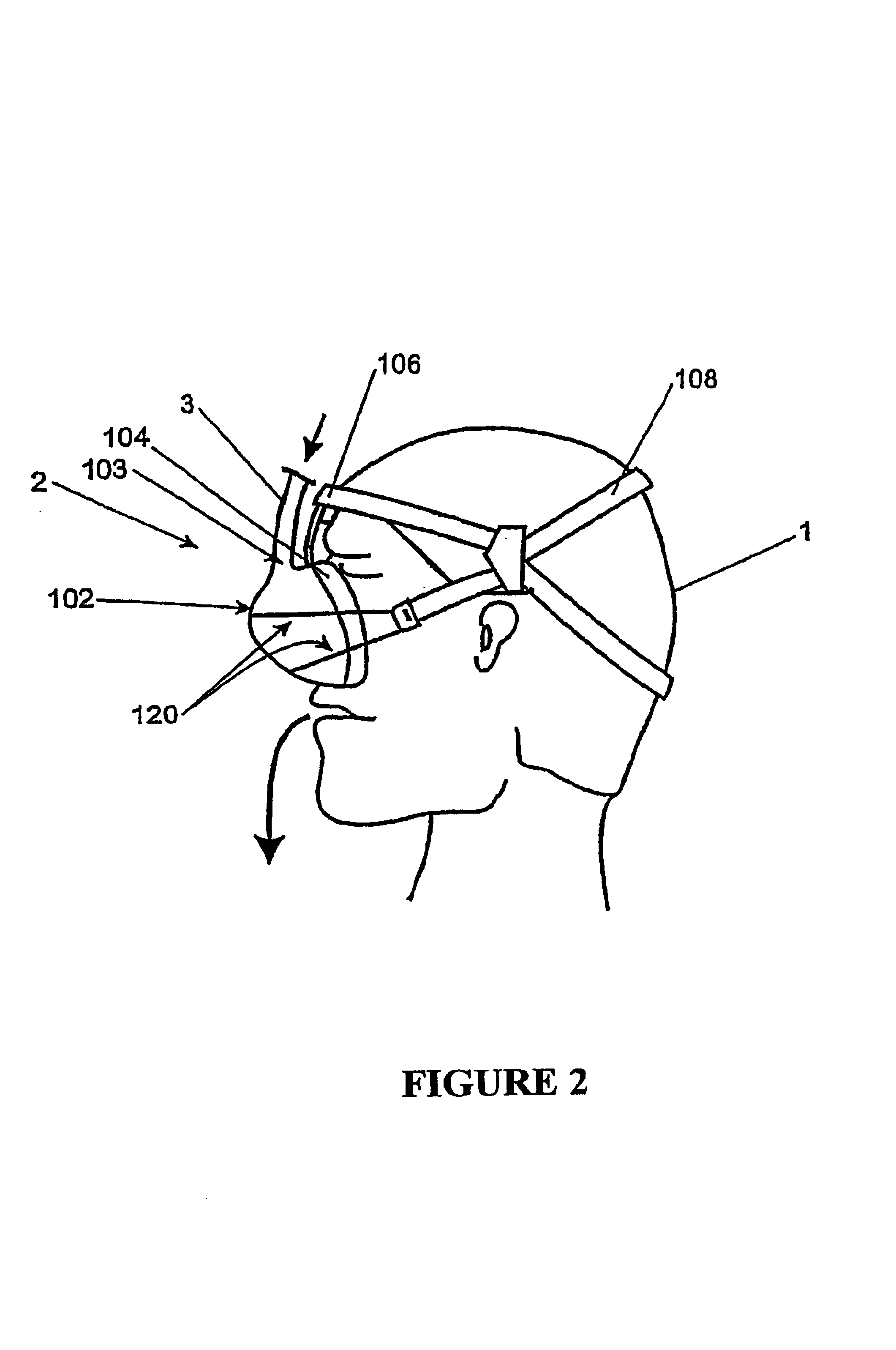 Breathing assistance apparatus