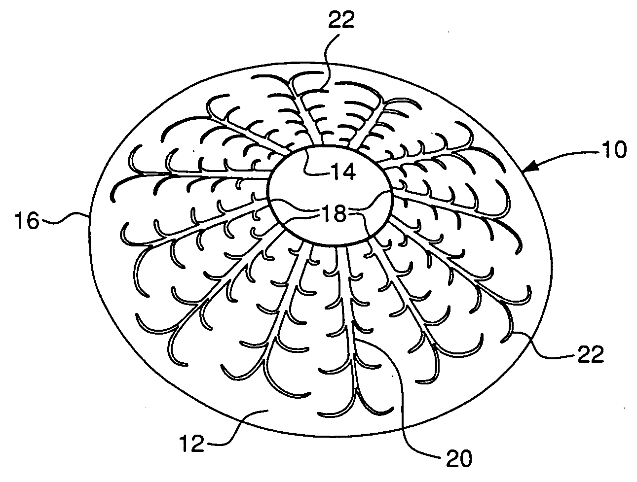 Audio loudspeaker