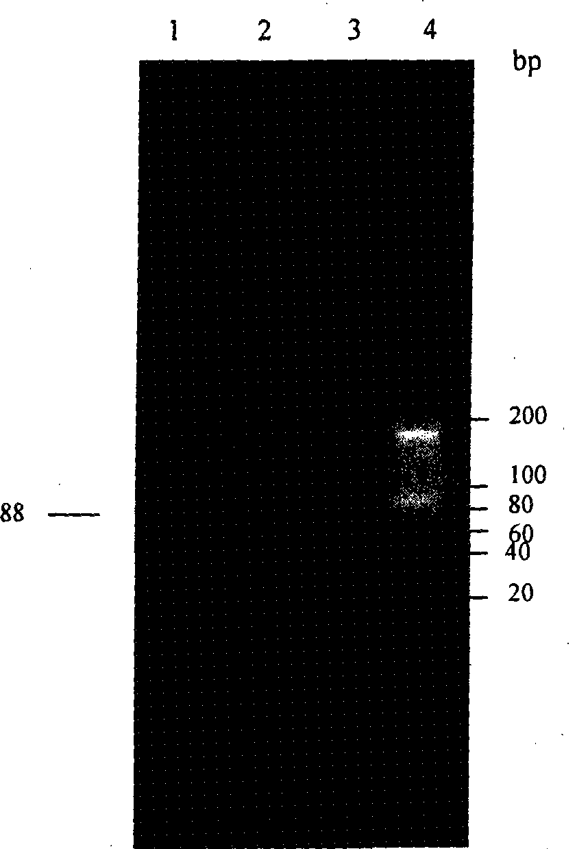 Construction and expression of vector of tumstatin T7 of tumstatin T7 peptide and derivative T7-NGR thereof