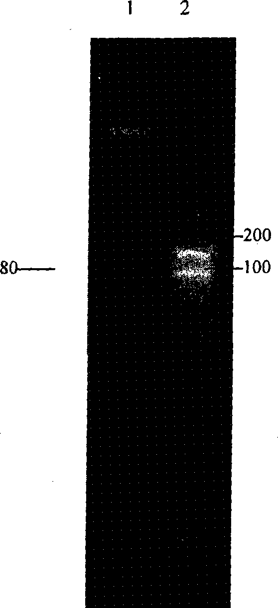 Construction and expression of vector of tumstatin T7 of tumstatin T7 peptide and derivative T7-NGR thereof