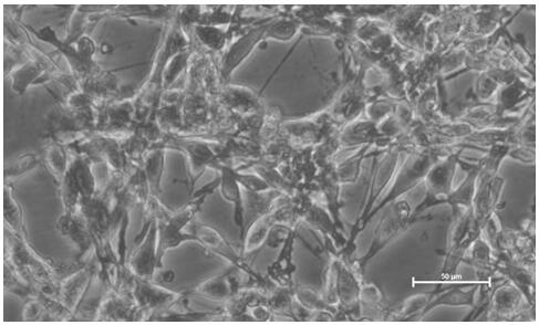 A kind of mouse fibroblast tumor cell line and application thereof